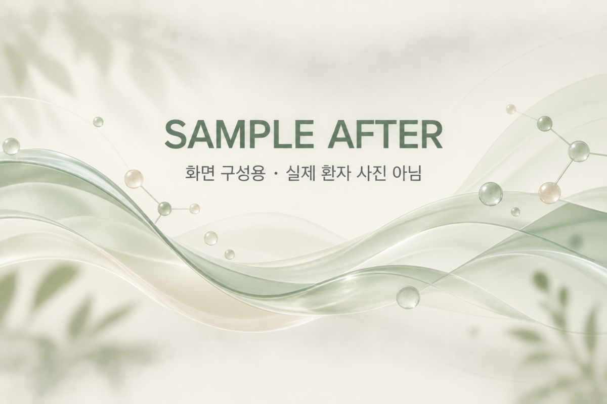 [샘플] 리쥬란 사례 카드 화면 구성용 AFTER 샘플